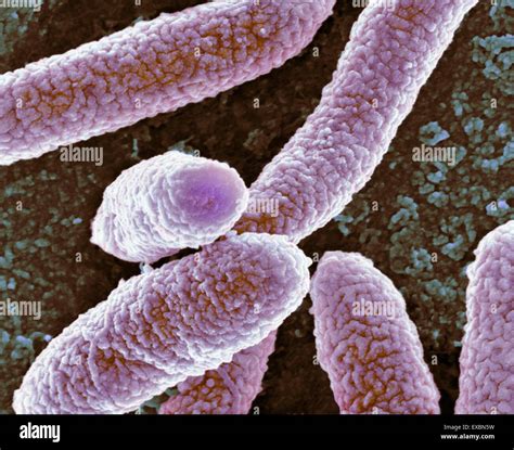 Coloured Scanning Electron Micrograph SEM Of Escherichia Coli Stock