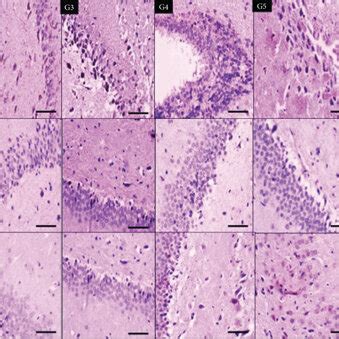 Immunohistochemical staining sections of the brain cortex of six groups ... 