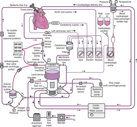 11: Cardiopulmonary Bypass | Anesthesia Key