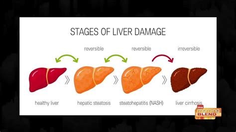 Is Your Liver Screaming For Help Here S How To Find Out Youtube