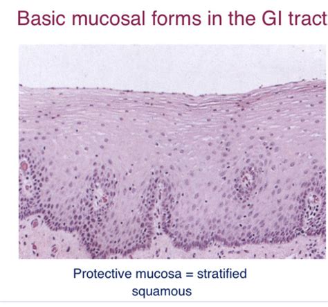 BMD181 The Gastrointestinal Tract Flashcards Quizlet