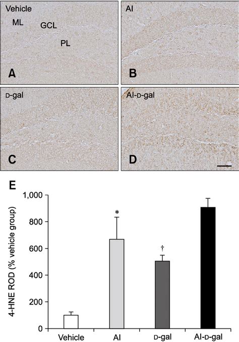 Immunohistochemistry For Hydroxynonenal Hne In The Dentate Gyrus