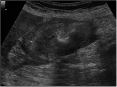 Abdomen and retroperitoneum | 1.6 Gastrointestinal tract : Case 1.6.6 Stomach and esophagus ...