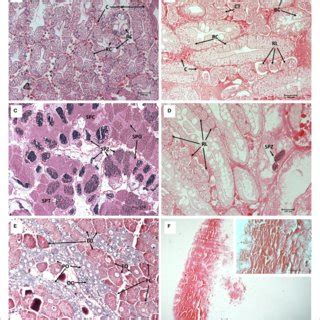 The Hepatopancreas And Gonad Histological Cross Sections Of Healthy