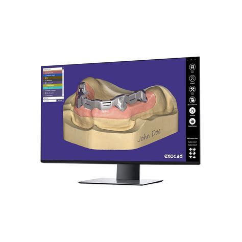 临床软件模块 Bar exocad GmbH 牙科 测量 设计