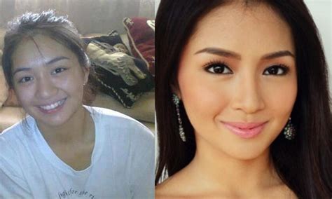 Kathryn Bernardo Before Nose Surgery Comparison