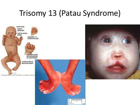 Gen Pathology Finals Pictures