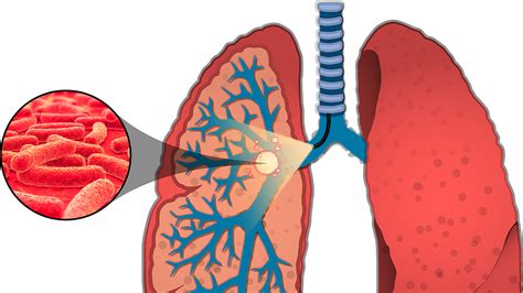 Maitland, team develop innovative way to effectively diagnose ...