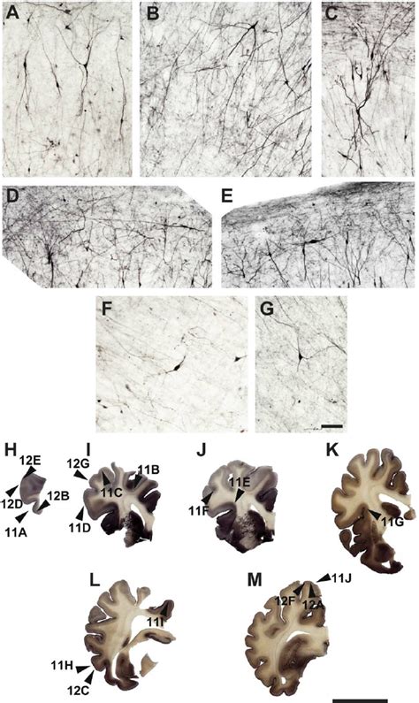 Photomicrographs Showing The Typical Bipolar And Fusiform Morphology As