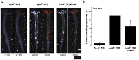 The Progression Of Atherosclerotic Lesions Is Significantly Reduced By