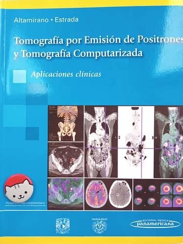 Tomografia Por Emision De Positrones Y Tomografia Computariz De