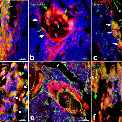 Identification Of Tdt Cells By Immunofluorescence Staining In