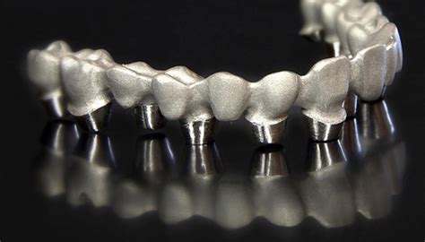 The 3d Printing Dental Market Is Booming 3dnatives