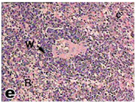 Light Micrograph Of Spleen Tissue From Tortoise Showing Three White