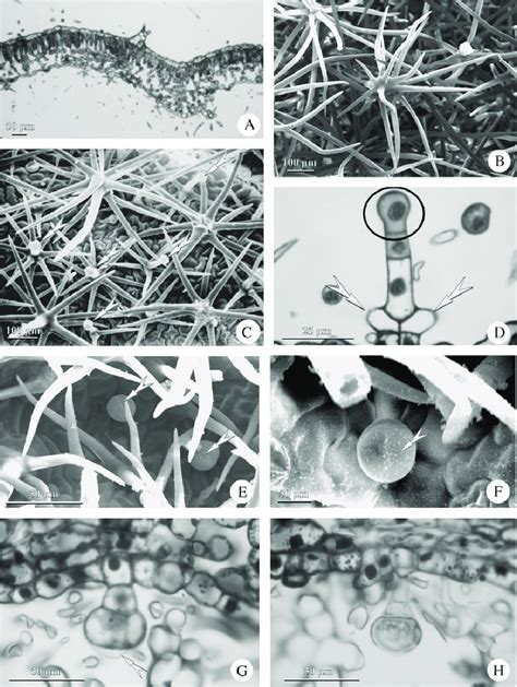 A General View Of Cross Sectioned Leaf Sections Of Trichomes And