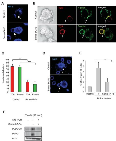 Sema A Blocks Actin And Tcr Polarization In Dc T Cell Contact Zone And