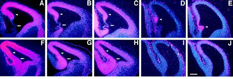 Control Of Hippocampal Morphogenesis And Neuronal Differentiation By