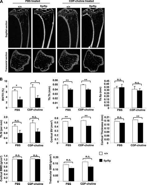 In Vivo Treatment With Cdp Choline Does Not Rescue The Bone Phenotype