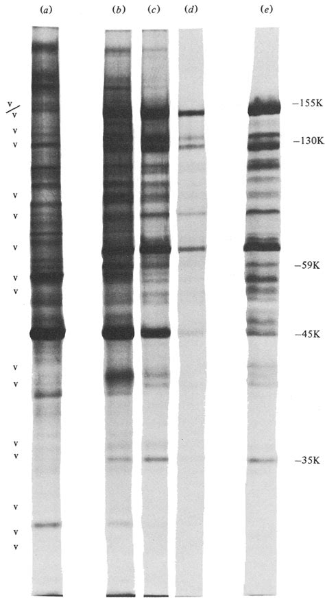 Sds Polyacrylamide Gel Electrophoresis Of Ref And Kb Cells Infected Download Scientific Diagram