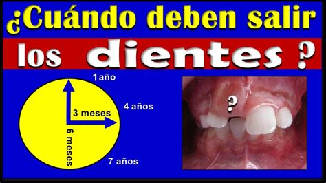 Cronolog A De Erupci N Dental Temporal Y Permanente Youtube