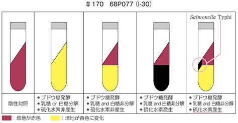 TSI培地での性状確認 臨床検査技師になろう国家試験対策に役立つ情報をお届け