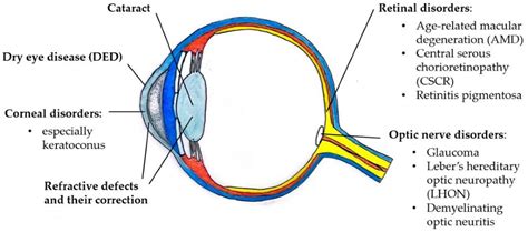 Ijms Free Full Text Sex Hormones And Their Effects On Ocular Disorders And Pathophysiology
