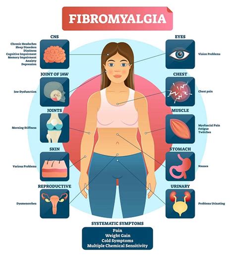 Cure For Fibromyalgia 2024 Aliza Belinda