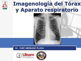 05 Imagenología del Aparato respiratorio 1593612771 pdf