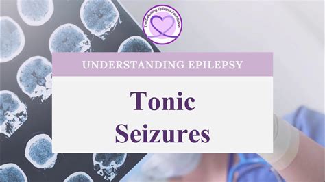 What Are Tonic Seizures Youtube