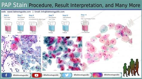 PAP Stain Procedure, Result, Interpretation And More| LTG