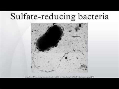 Sulfate reducing bacteria - Alchetron, the free social encyclopedia