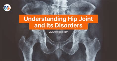 Understanding Hip Joint And Its Disorders Mbbch Health Encyclopedia