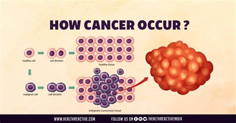 Understanding The Intricacies Of Cancer Development Health Reactive