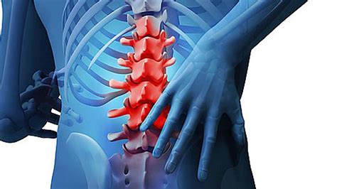 Lumbalgia Qué Es Síntomas Diagnóstico Y Tratamientos