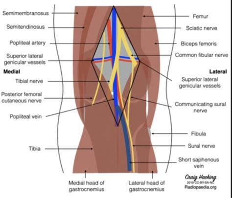 Orthopaedic Knee Leg Pathology Flashcards Quizlet