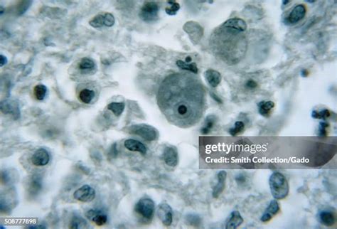 Entamoeba Histolytica Photos And Premium High Res Pictures Getty Images