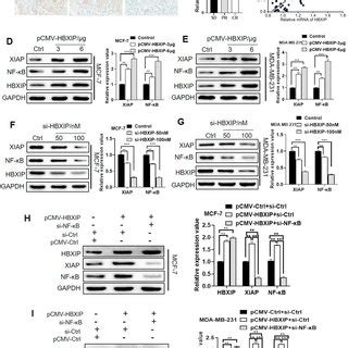 Hbxip Upregulates Xiap Through Nf B Signaling In Irradiated Breast