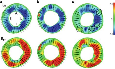 Circumferential Strains E Cc And Radial Strains E Rr Of Two