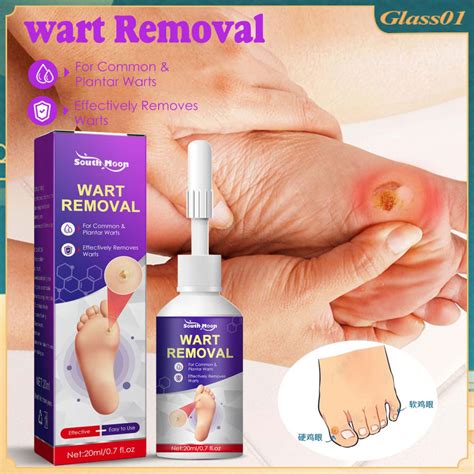 South Moon Corn Removal Extra Strengthen Gel Warts Skin Remover Wart