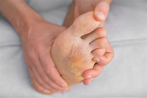 ¿sabías Que El Podólogo Cuida La Salud De Los Pies Saludiario