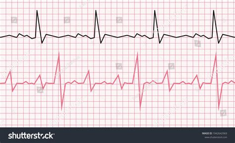 Cardiogram On Graph Paper Heartbeat Line Stock Vector Royalty Free 1942642969 Shutterstock