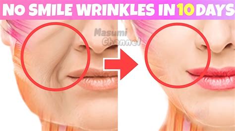 7min Anti Aging Face Lifting Exercises For Laugh Lines Jowls