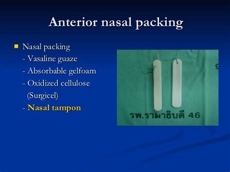 nasal injury by DILEEP ANTO