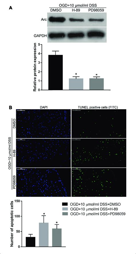 Protein Kinase Alpha Or Erk12 Inhibition Abolishes The Dss Induced