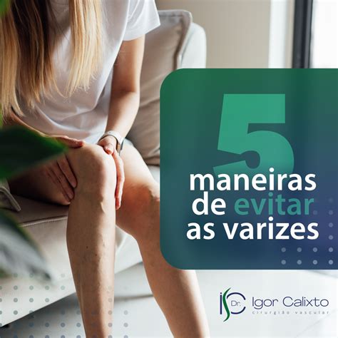 MANEIRAS DE EVITAR AS VARIZES Dr Igor Calixto