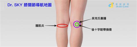 Dr Sky 膝關節痛導航地圖 12種膝關節病因一次看懂 Dr Sky 名冠診所