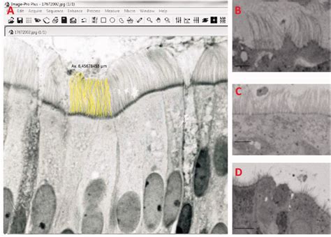 Example Of Cilia Measure 1A Normal Length Cilia 1B Normal At The