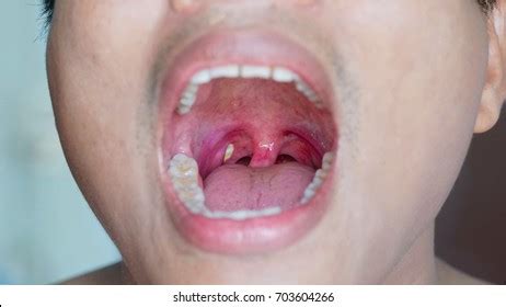 Pharynx Photos Images Pictures Shutterstock