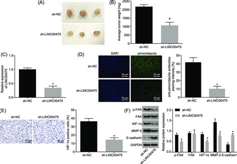 Silencing Of Linc Induces Oxidation And Represses The Growth Of