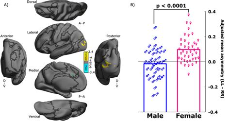 Interaction Between The Laterality Of Superior Daccs Ipsilateral